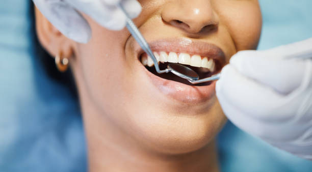 Best Chipped Tooth Repair Near Me  in Friedens, PA